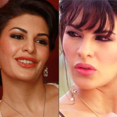 Bollywood Celebrity Lip Jobs that Failed to Impress