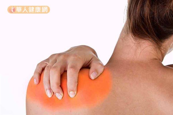 肩膀疼痛不見得都是五十肩才會出現的症狀，有時可能因關節鈣化造成旋轉肌腱發炎。