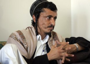 Jewish rabbi Yahya Youssef Moussa, listens during an interview with Reuters in Sanaa in this - 2015-02-15T161700Z_883989921_GM1EB2G00N401_RTRMADP_3_YEMEN-SECURITY-JEWS