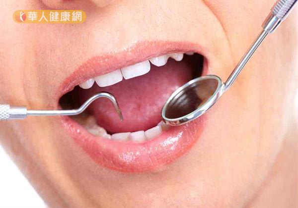 面對惱人的牙周病問題，拔與不拔牙，對於後續口腔整體健康事關重大。到底罹患牙周病，該不該拔牙呢？