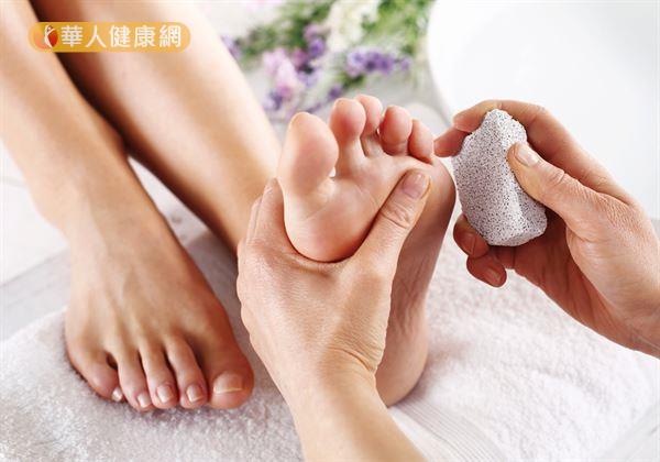 趙昭明醫師指出，一般建議在正常狀態下，磨腳皮的幅度與次數，最好控制在1週1到2次的輕度磨除，且不會感到疼痛程度內為佳。