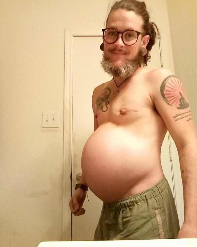 Transgender Gay Porn - zigbeenuthouse - Transgender man (woman) gives birth (Porn Pic)