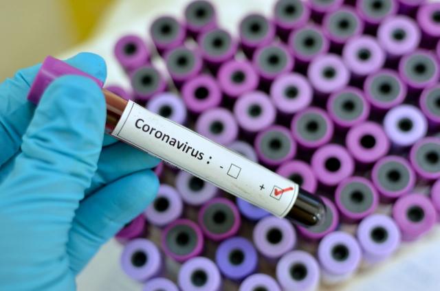 Una simulación del riesgo de coronavirus realizada el año pasado dio resultados espantosos (Imagen: Getty).