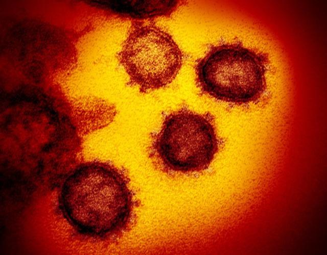APphoto_Virus Outbreak Home Test